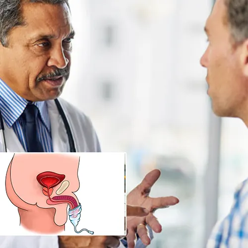 Understanding the Value of Penile Implant Surgery