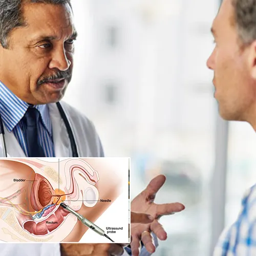 Comparing Non-Surgical Treatments with Penile Implants